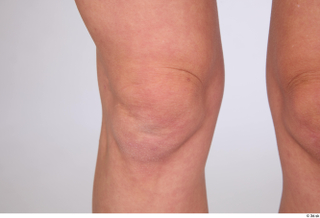 Riva knee 0004.jpg